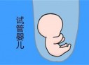 培养嘉兴捐卵宝宝艺术细胞的小技巧